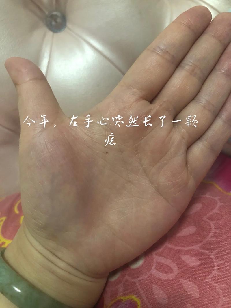 为什么说左手长痣是被辜负