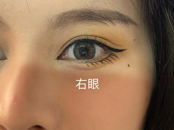 右眼睫毛根内长痣命运怎么样
