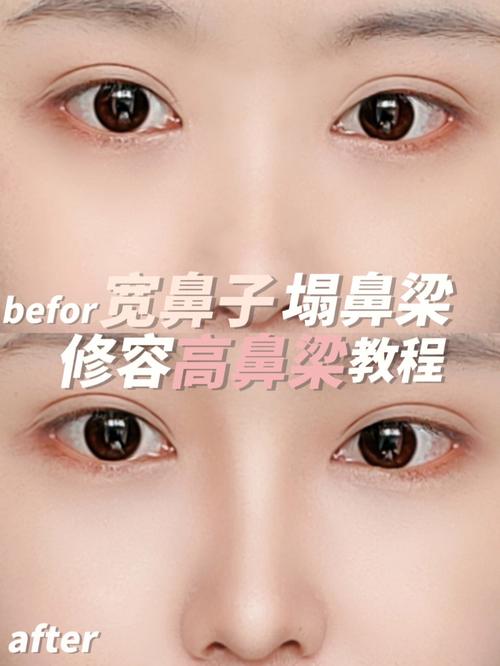 梦见鼻梁 鼻柱是什么意思