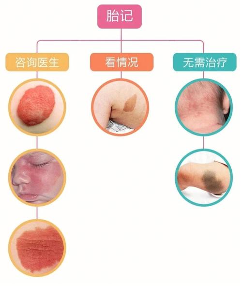 身体各部位胎记的图解