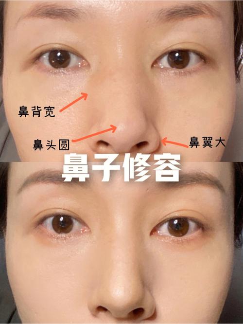 鼻孔外翻的人适不适合当官呢