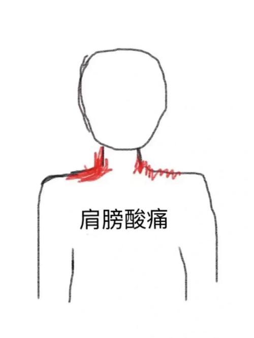 肩膀的体相解析大全