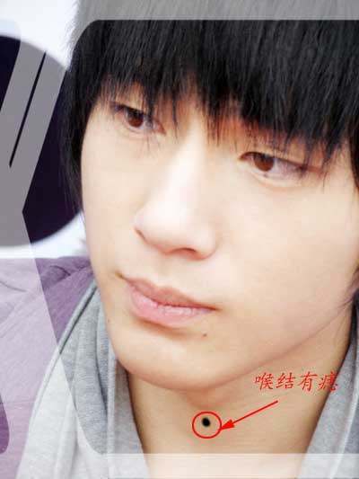 男人痣相,喉结的痣会导致一生发展不顺吗