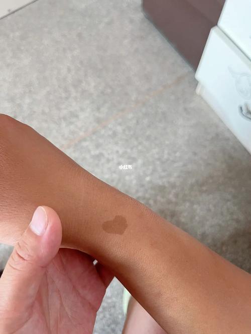 手上的胎记是什么意思?