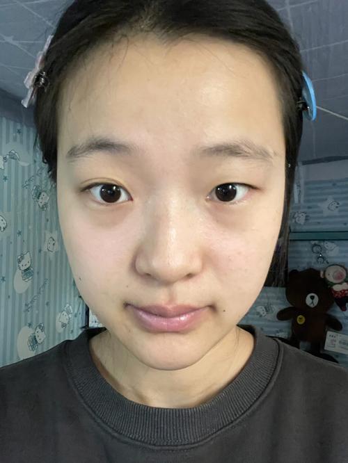 大小眼好不好,大小眼该怎么办