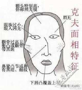 颧骨高克夫还是旺夫