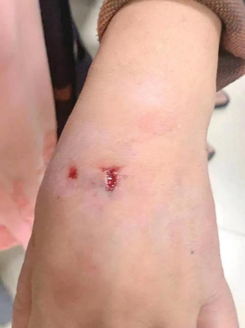 狗咬过人一次就会经常咬人