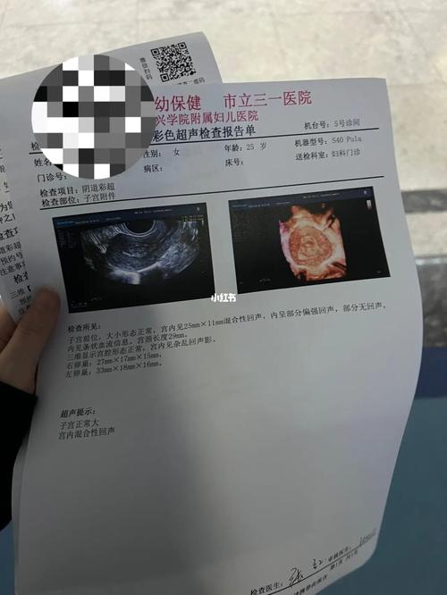 人流后有血可以复查吗