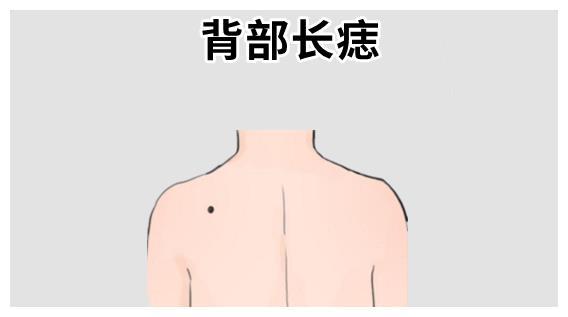 女人后背有痣命苦是真的吗