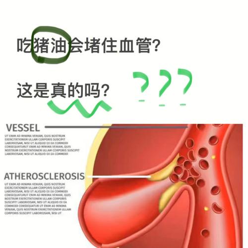 A型血不能吃猪油吗