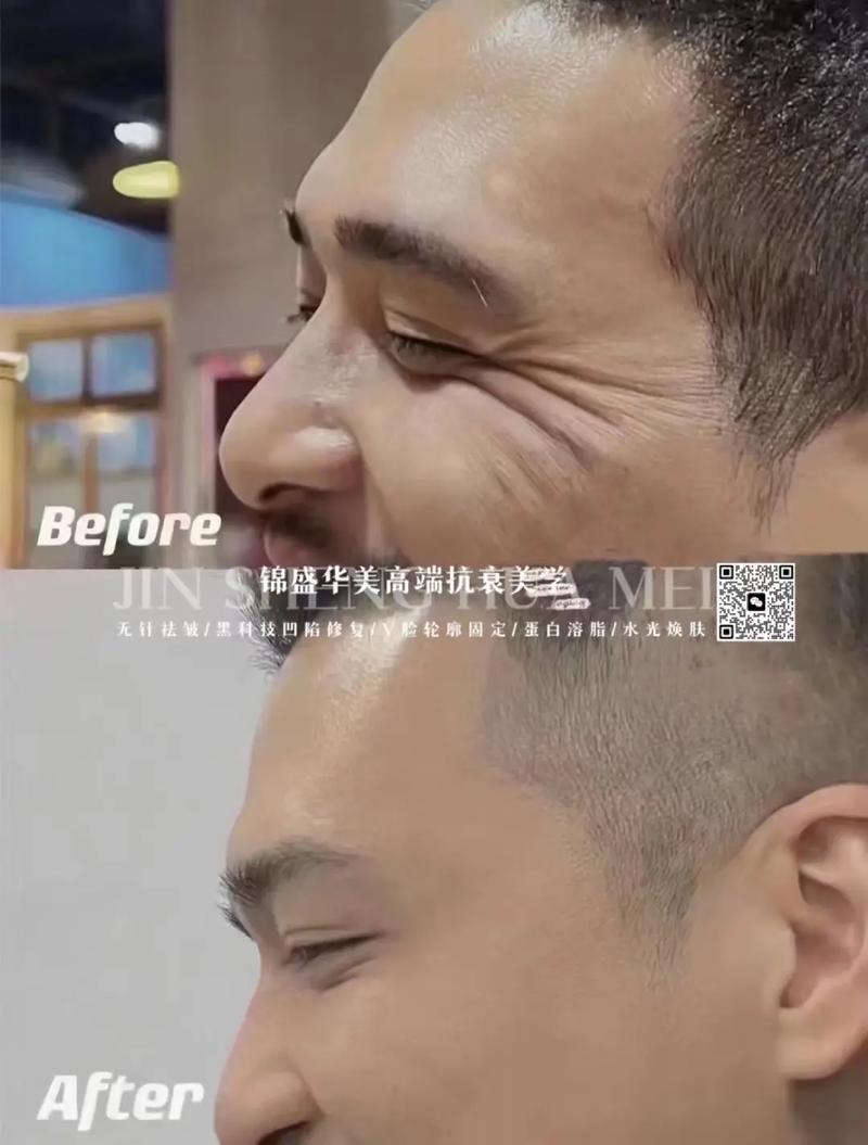 天生抬头纹的人好吗(详解)