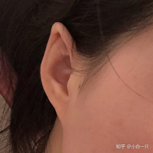 耳朵上端尖好不好