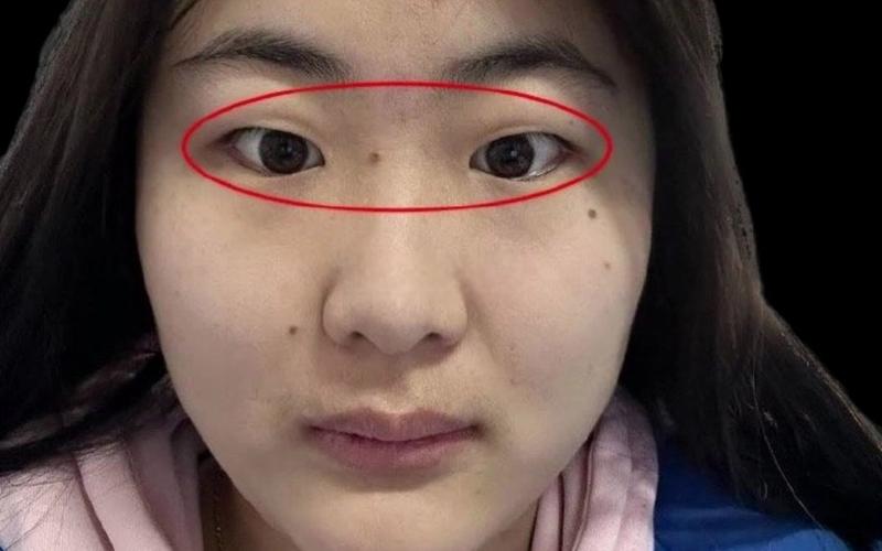 斗鸡眼的面相是好面相吗