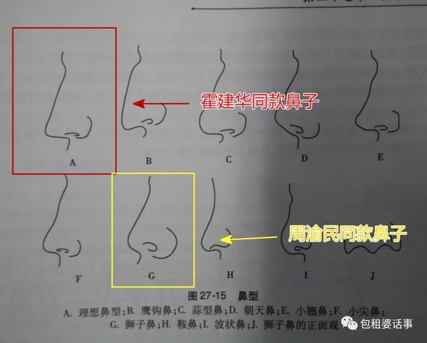 狮子鼻与蒜头鼻的区别