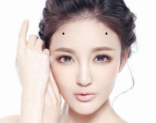 额头上的美人痣好不好?