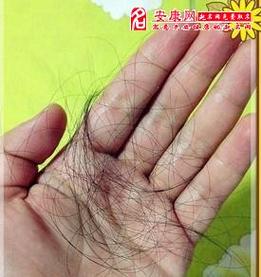 男人梦见掉头发是什么意思