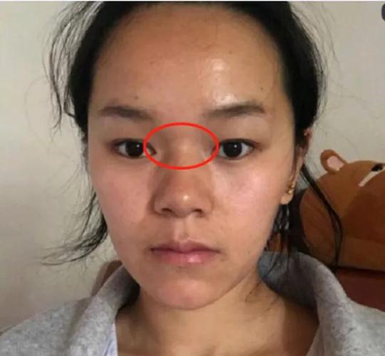 女人山根上有横纹感情难