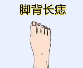 脚背上长痣是什么意思,注定奔波一生吗
