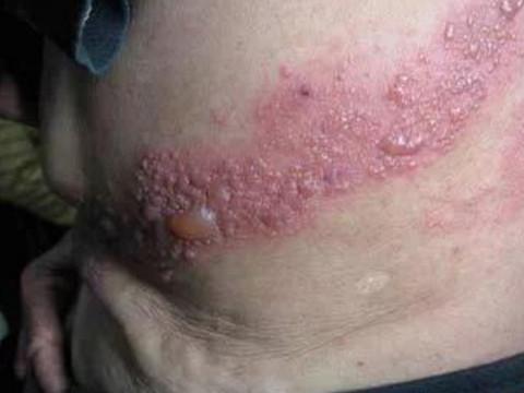 女人梦见蛇缠腰但没咬