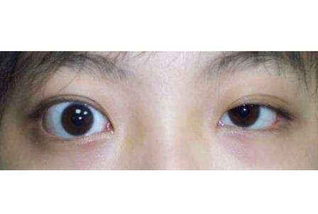 易毁容的八字什么样