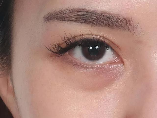 卧蚕眼是什么样的