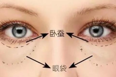 女人有卧蚕代表什么