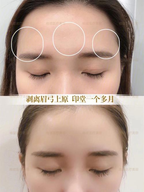 眉骨高印堂凹陷眉毛粗的面相说明了什么