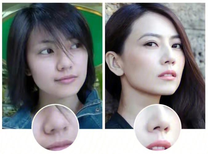 鼻子过长的人做事情瞻前顾后是真的吗