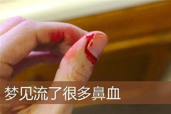 梦见口鼻出血 周公解梦之梦到口鼻出血