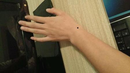 手腕长痣有什么影响?好不好?