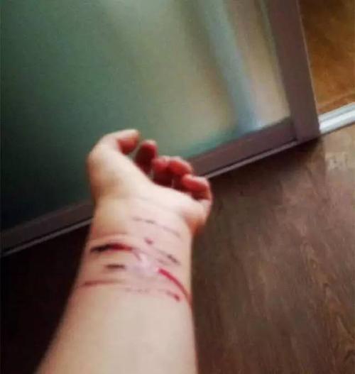 梦见割腕怎么回事