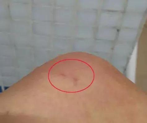 女人梦见被蜈蚣咬是什么预兆