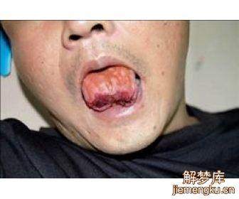 梦见自己舌头断了是什么
