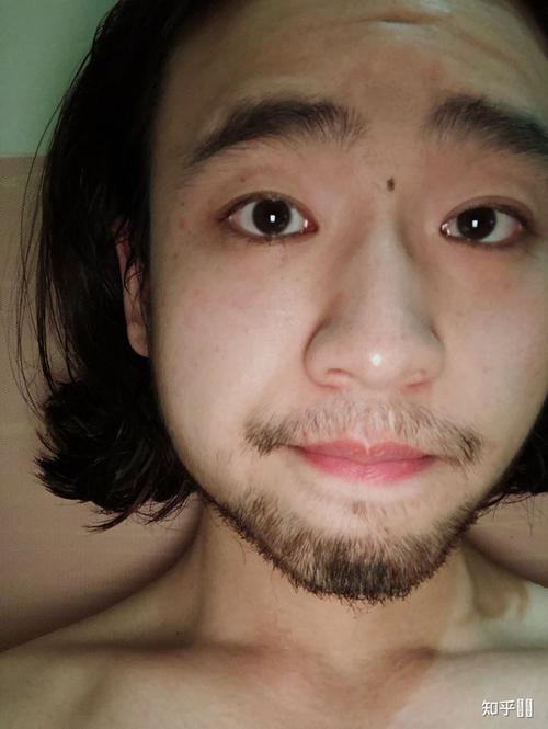 男人长美人痣好吗
