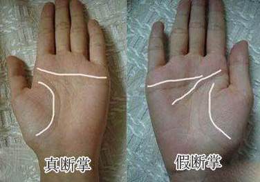 两只手都是断掌的男孩多吗