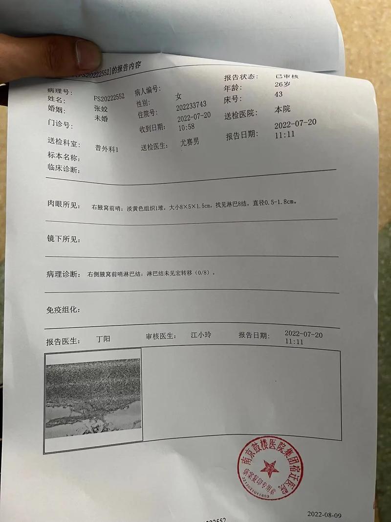 女人梦见自己得了肿瘤是什么意思