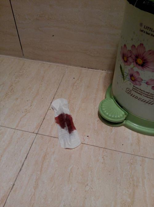 梦见卫生巾满满的是血有什么征兆