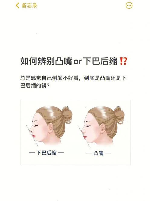 下巴后缩代表什么含义呢