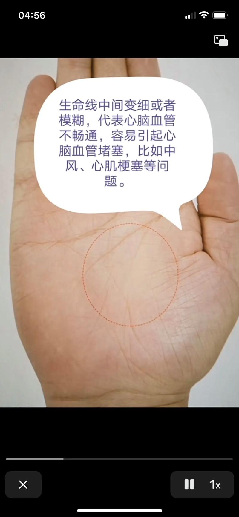 生命线断裂预示着什么