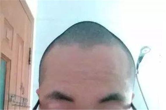 头顶正中骨头凸起面相