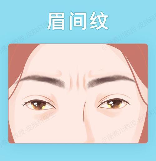 眉间坚纹代表什么