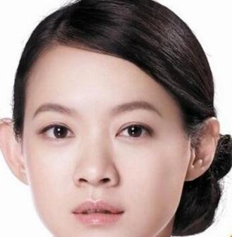 女孩子长一对招风耳好吗