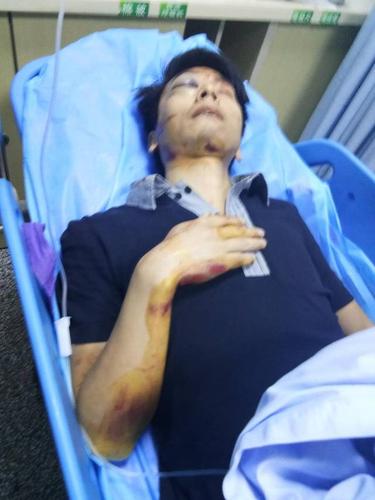 梦到老公出车祸是什么预兆