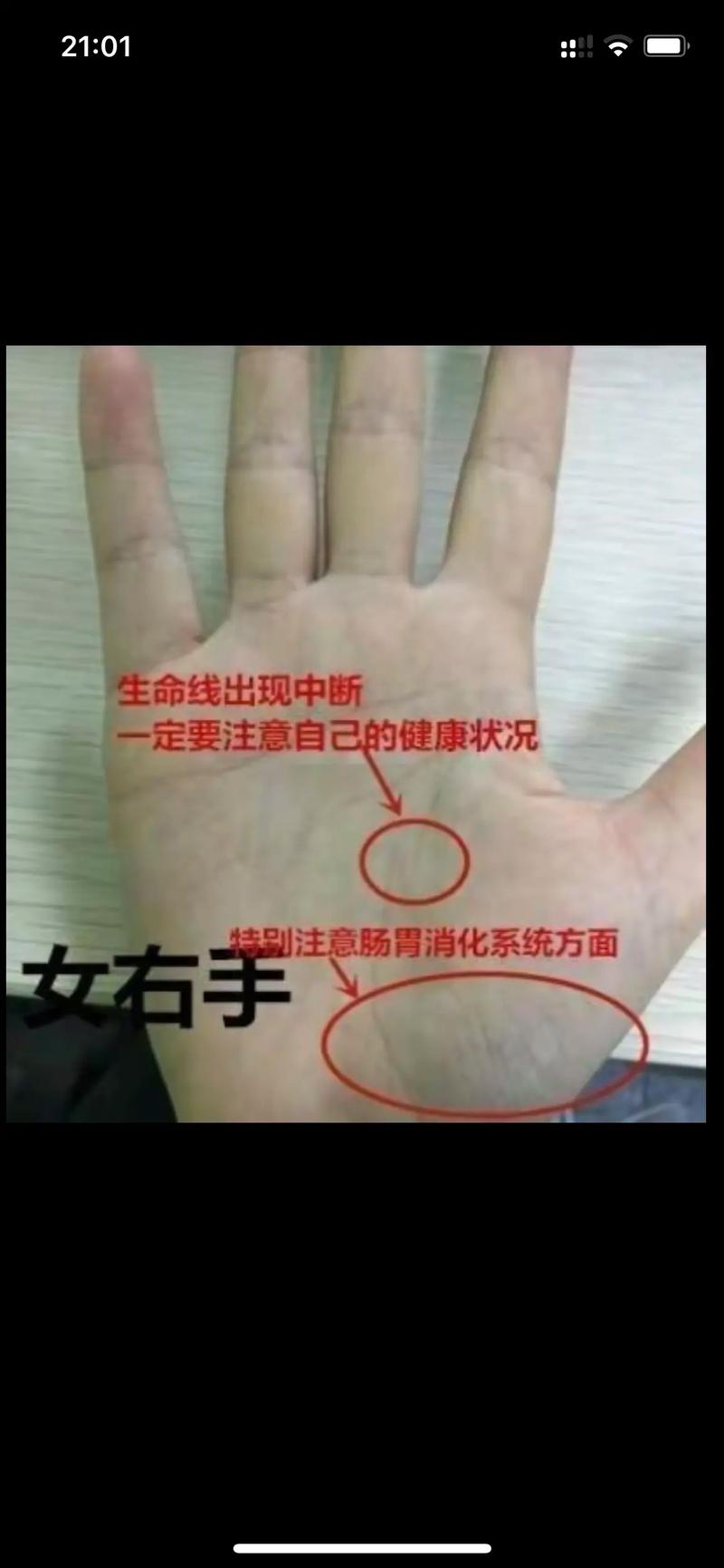生命线断开呈平行两条详解