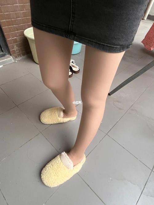 梦见腿坏的妈妈腿变好了是什么预兆