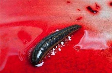 梦见蚂蝗缠身,最近杂事一堆