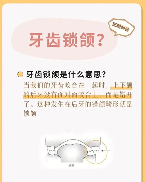 牙齿尖代表的意思?