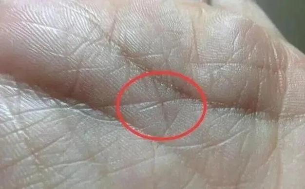 手掌正中心十字纹