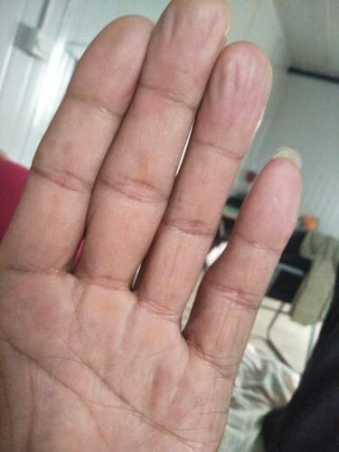 手指肚饱满是有福气