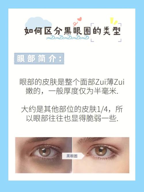 黑眼圈的面相代表什么